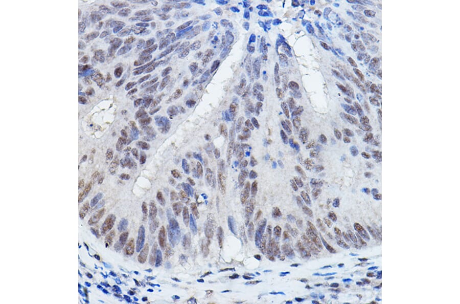 Immunohistochemistry - Anti-DGCR8 Antibody (A305592) - Antibodies.com