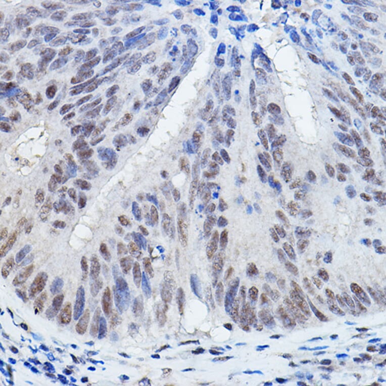 Immunohistochemistry - Anti-DGCR8 Antibody (A305592) - Antibodies.com