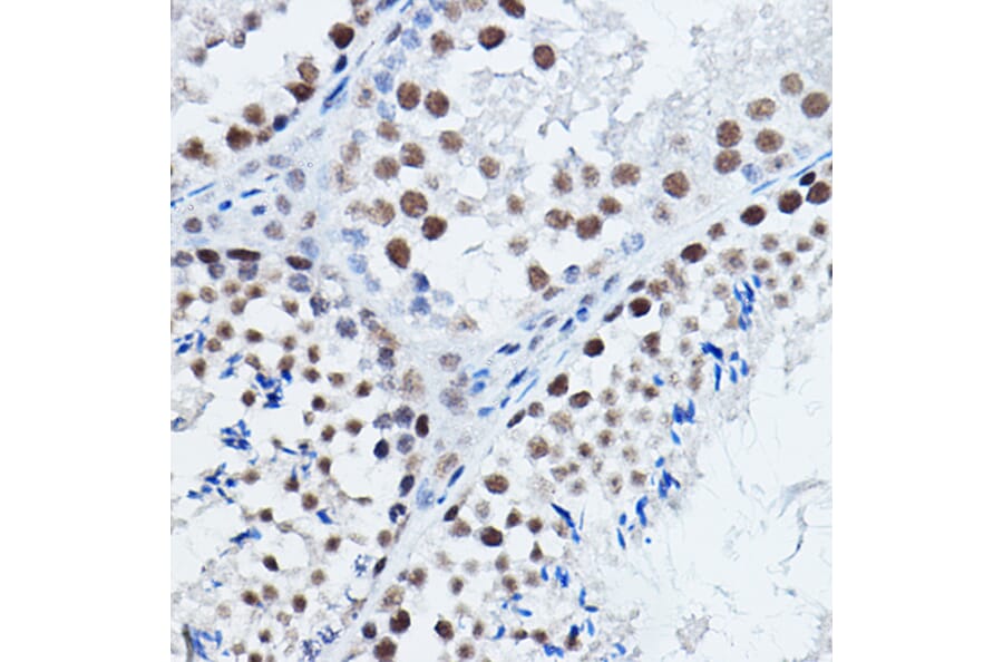 Immunohistochemistry - Anti-DGCR8 Antibody (A305592) - Antibodies.com