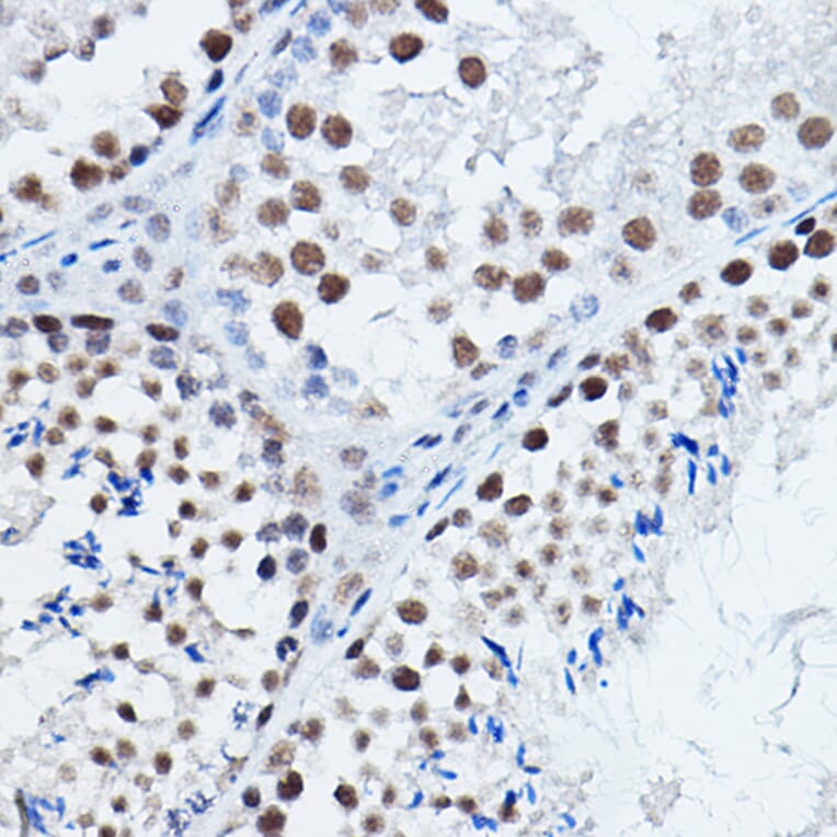 Immunohistochemistry - Anti-DGCR8 Antibody (A305592) - Antibodies.com