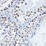 Immunohistochemistry - Anti-DGCR8 Antibody (A305592) - Antibodies.com