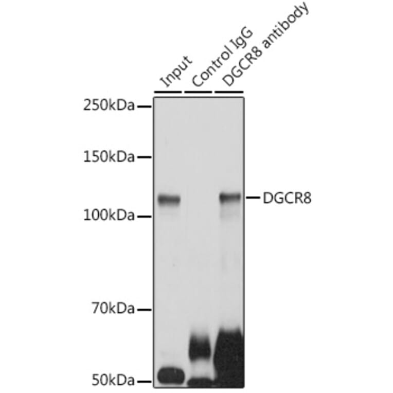 Western Blot - Anti-DGCR8 Antibody (A305592) - Antibodies.com