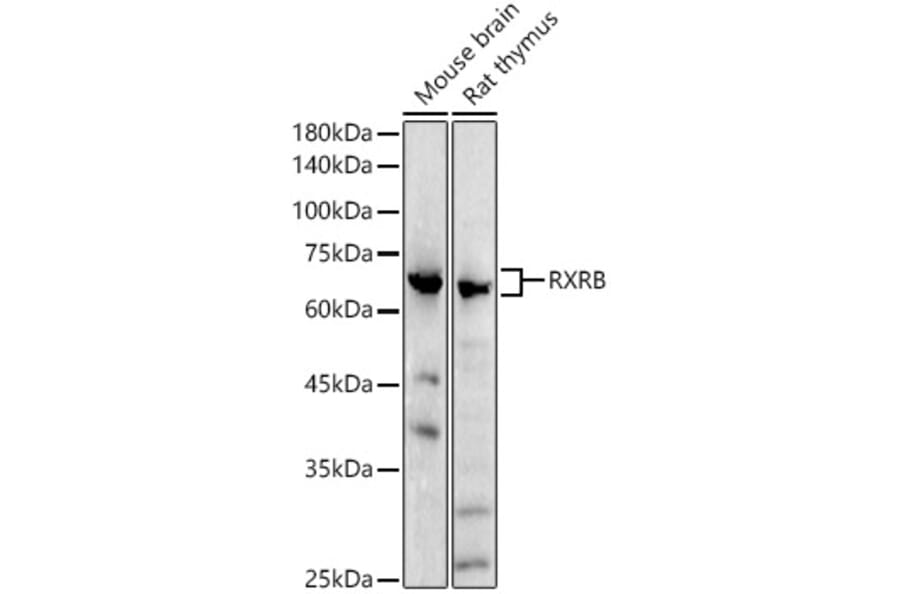 Western Blot - Anti-Retinoid X Receptor beta/RXRB Antibody (A305594) - Antibodies.com