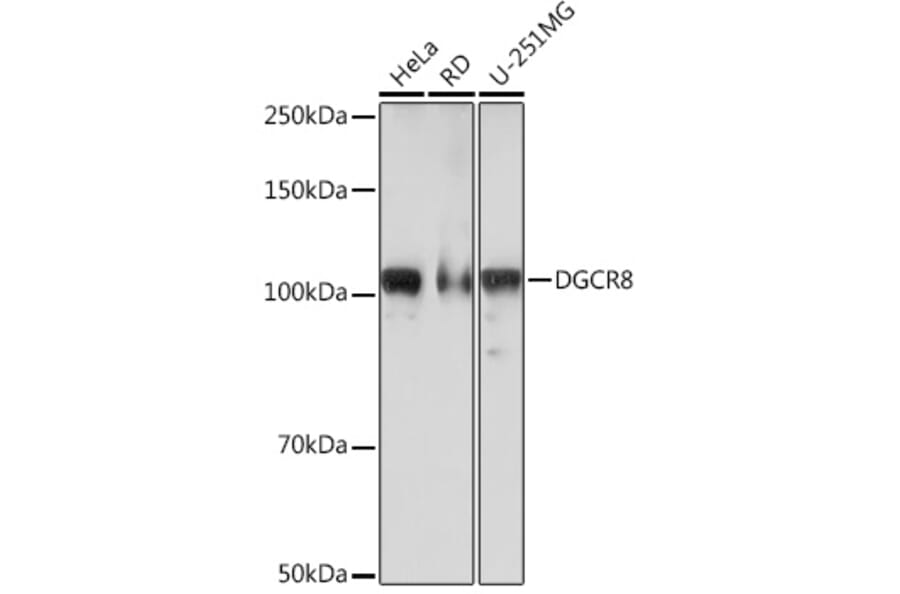 Western Blot - Anti-DGCR8 Antibody [ARC0289] (A305598) - Antibodies.com