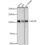 Western Blot - Anti-DGCR8 Antibody [ARC0289] (A305598) - Antibodies.com