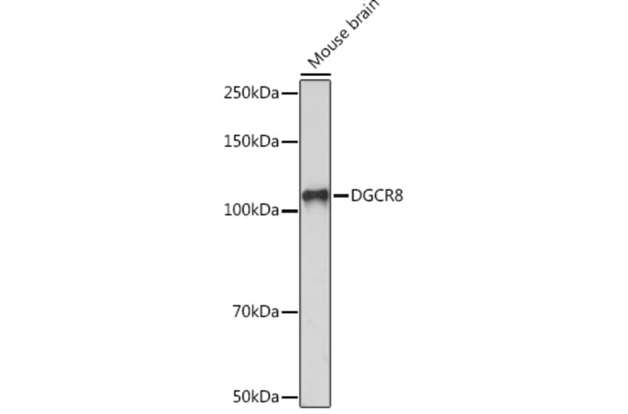 Western Blot - Anti-DGCR8 Antibody [ARC0289] (A305598) - Antibodies.com