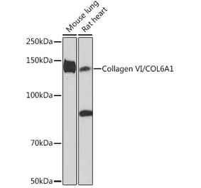 Western Blot - Anti-Collagen VI Antibody [ARC1725] (A305599) - Antibodies.com