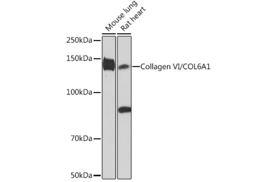 Western Blot - Anti-Collagen VI Antibody [ARC1725] (A305599) - Antibodies.com