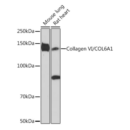 Western Blot - Anti-Collagen VI Antibody [ARC1725] (A305599) - Antibodies.com