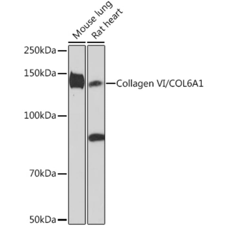 Western Blot - Anti-Collagen VI Antibody [ARC1725] (A305599) - Antibodies.com