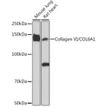 Western Blot - Anti-Collagen VI Antibody [ARC1725] (A305599) - Antibodies.com