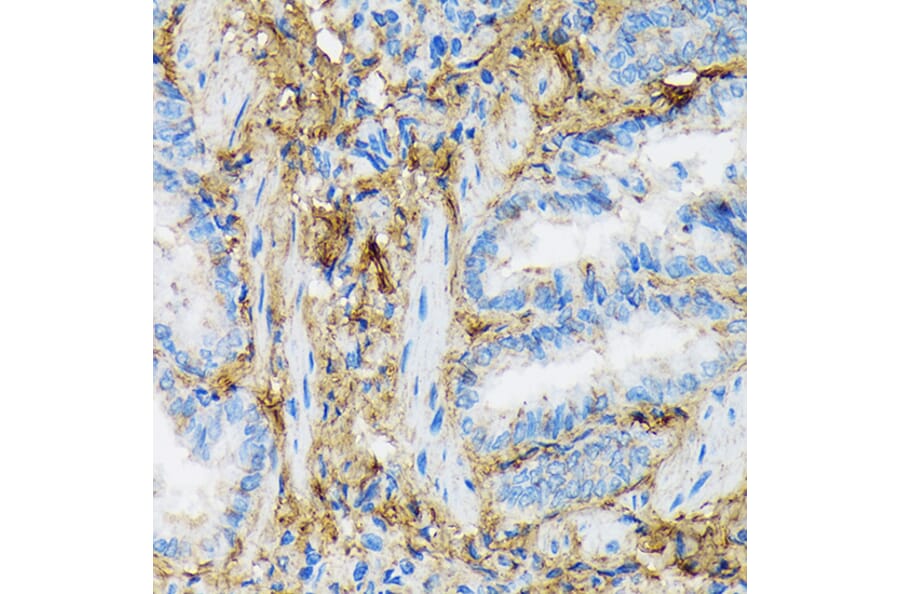 Immunohistochemistry - Anti-Collagen VI Antibody [ARC1725] (A305599) - Antibodies.com