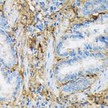 Immunohistochemistry - Anti-Collagen VI Antibody [ARC1725] (A305599) - Antibodies.com