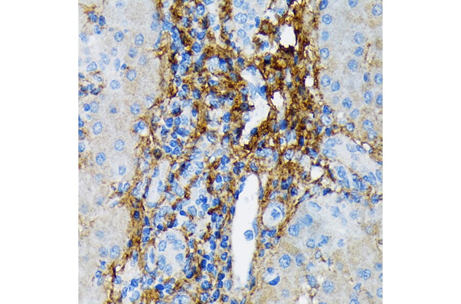 Immunohistochemistry - Anti-Collagen VI Antibody [ARC1725] (A305599) - Antibodies.com