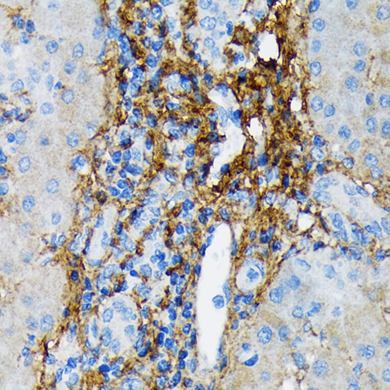 Immunohistochemistry - Anti-Collagen VI Antibody [ARC1725] (A305599) - Antibodies.com