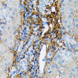 Immunohistochemistry - Anti-Collagen VI Antibody [ARC1725] (A305599) - Antibodies.com