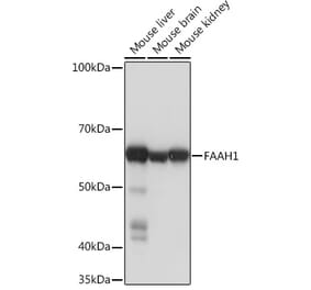 Western Blot - Anti-FAAH1 Antibody [ARC0903] (A305600) - Antibodies.com