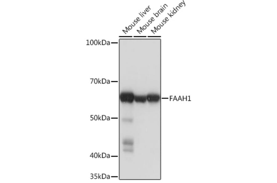 Western Blot - Anti-FAAH1 Antibody [ARC0903] (A305600) - Antibodies.com