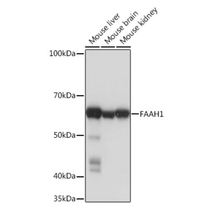 Western Blot - Anti-FAAH1 Antibody [ARC0903] (A305600) - Antibodies.com