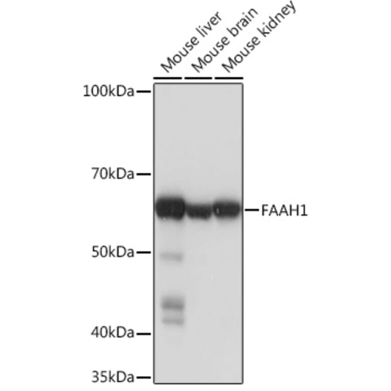 Western Blot - Anti-FAAH1 Antibody [ARC0903] (A305600) - Antibodies.com