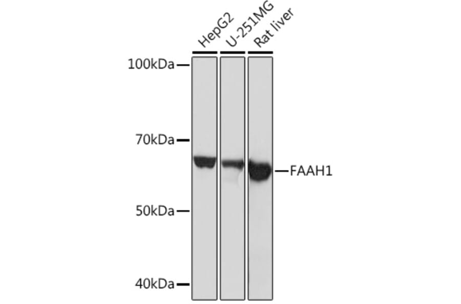 Western Blot - Anti-FAAH1 Antibody [ARC0903] (A305600) - Antibodies.com