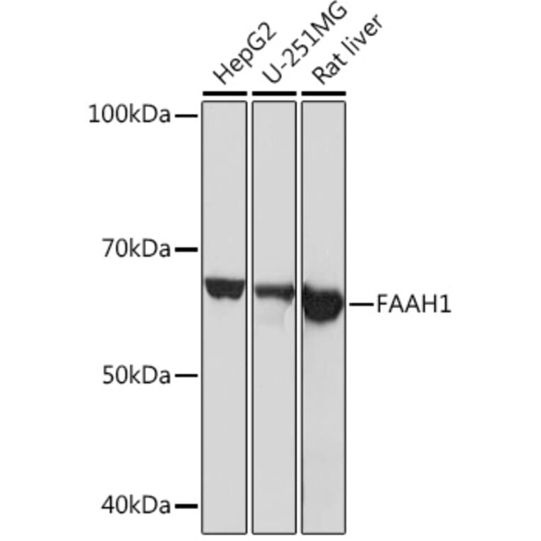 Western Blot - Anti-FAAH1 Antibody [ARC0903] (A305600) - Antibodies.com