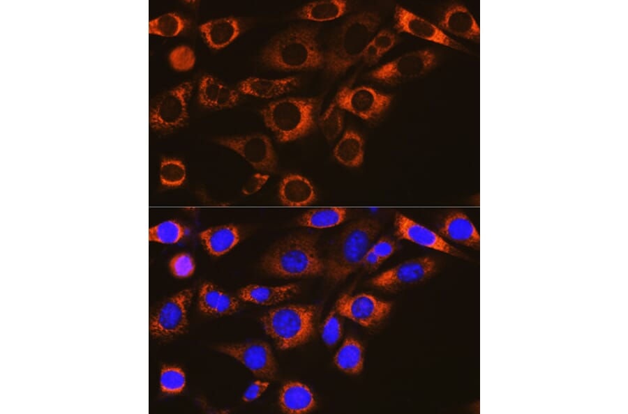 Immunofluorescence - Anti-FAAH1 Antibody [ARC0903] (A305600) - Antibodies.com