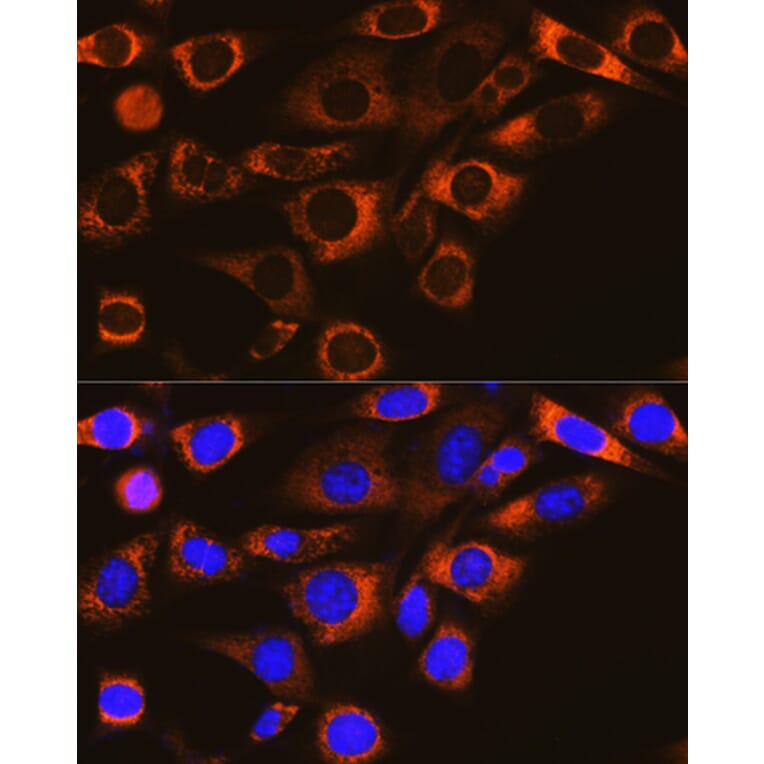 Immunofluorescence - Anti-FAAH1 Antibody [ARC0903] (A305600) - Antibodies.com
