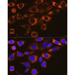 Immunofluorescence - Anti-FAAH1 Antibody [ARC0903] (A305600) - Antibodies.com