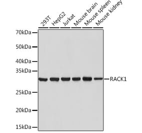 Western Blot - Anti-RACK1 Antibody [ARC0837] (A305601) - Antibodies.com
