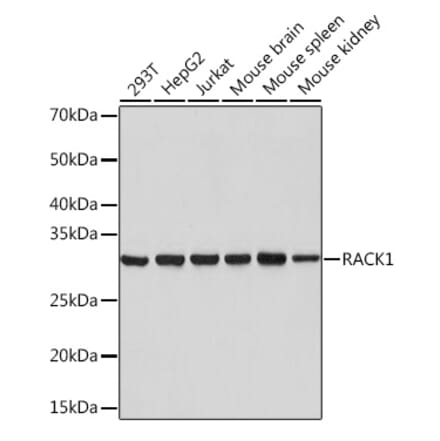 Western Blot - Anti-RACK1 Antibody [ARC0837] (A305601) - Antibodies.com