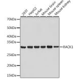 Western Blot - Anti-RACK1 Antibody [ARC0837] (A305601) - Antibodies.com