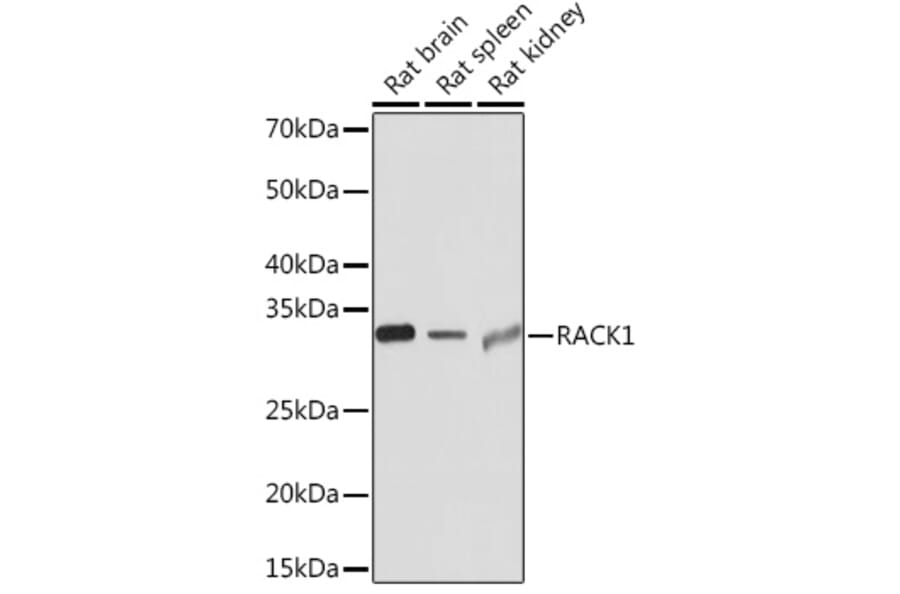Western Blot - Anti-RACK1 Antibody [ARC0837] (A305601) - Antibodies.com