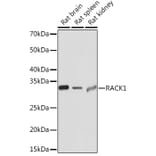 Western Blot - Anti-RACK1 Antibody [ARC0837] (A305601) - Antibodies.com