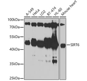 Western Blot - Anti-SIRT6 Antibody (A305602) - Antibodies.com