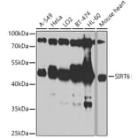 Western Blot - Anti-SIRT6 Antibody (A305602) - Antibodies.com