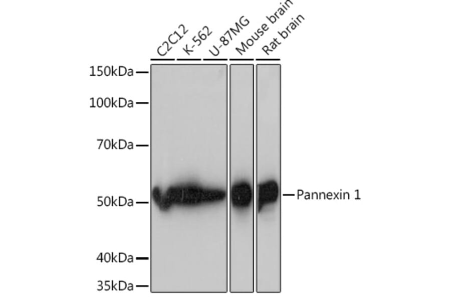 Western Blot - Anti-Pannexin 1 Antibody [ARC1207] (A305603) - Antibodies.com
