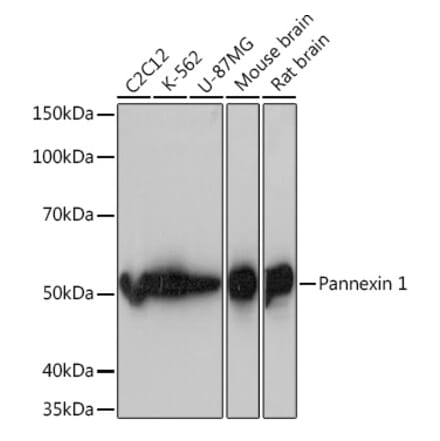 Western Blot - Anti-Pannexin 1 Antibody [ARC1207] (A305603) - Antibodies.com
