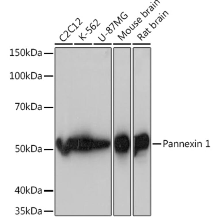 Western Blot - Anti-Pannexin 1 Antibody [ARC1207] (A305603) - Antibodies.com
