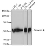 Western Blot - Anti-Pannexin 1 Antibody [ARC1207] (A305603) - Antibodies.com
