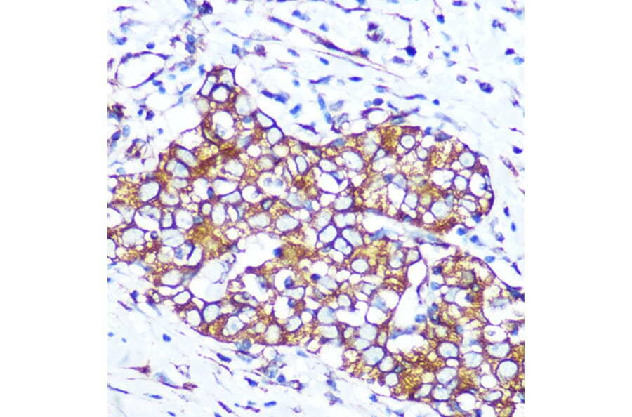Immunohistochemistry - Anti-Pannexin 1 Antibody [ARC1207] (A305603) - Antibodies.com