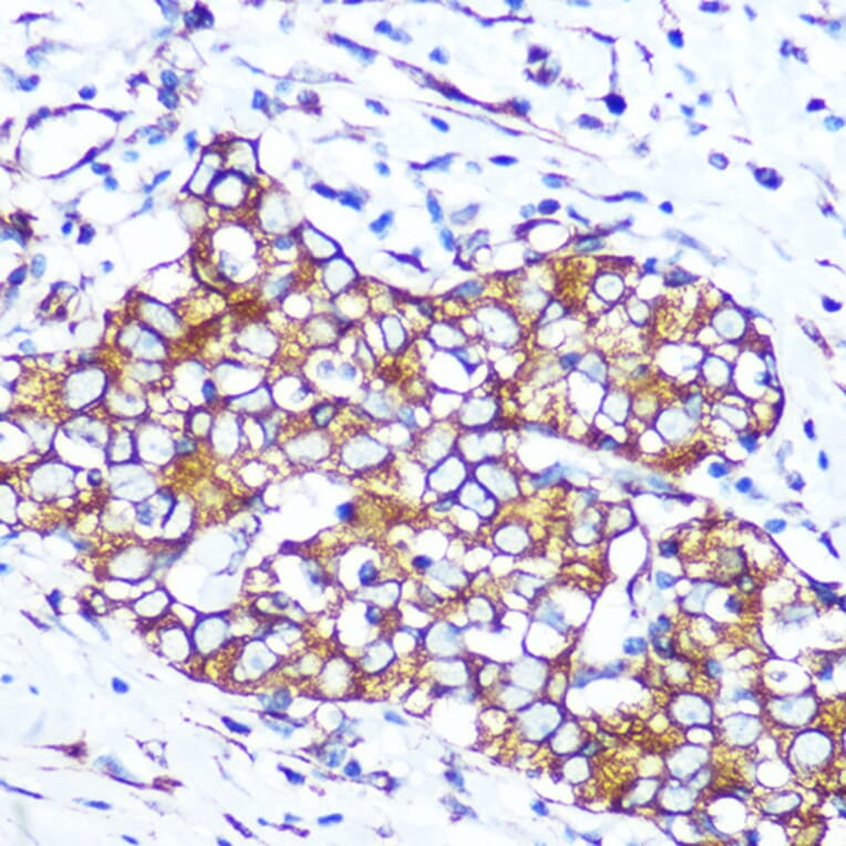 Immunohistochemistry - Anti-Pannexin 1 Antibody [ARC1207] (A305603) - Antibodies.com