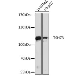 Western Blot - Anti-TSHZ3 Antibody (A305604) - Antibodies.com