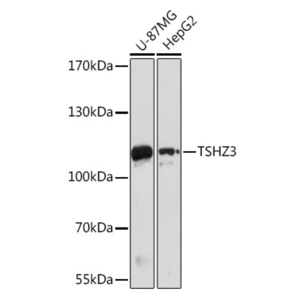 Western Blot - Anti-TSHZ3 Antibody (A305604) - Antibodies.com
