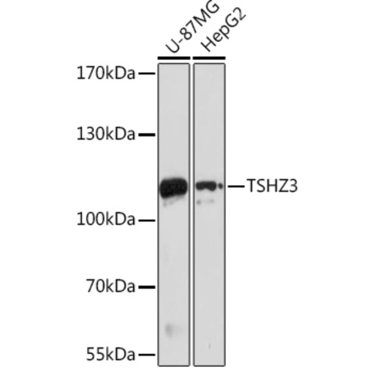 Western Blot - Anti-TSHZ3 Antibody (A305604) - Antibodies.com