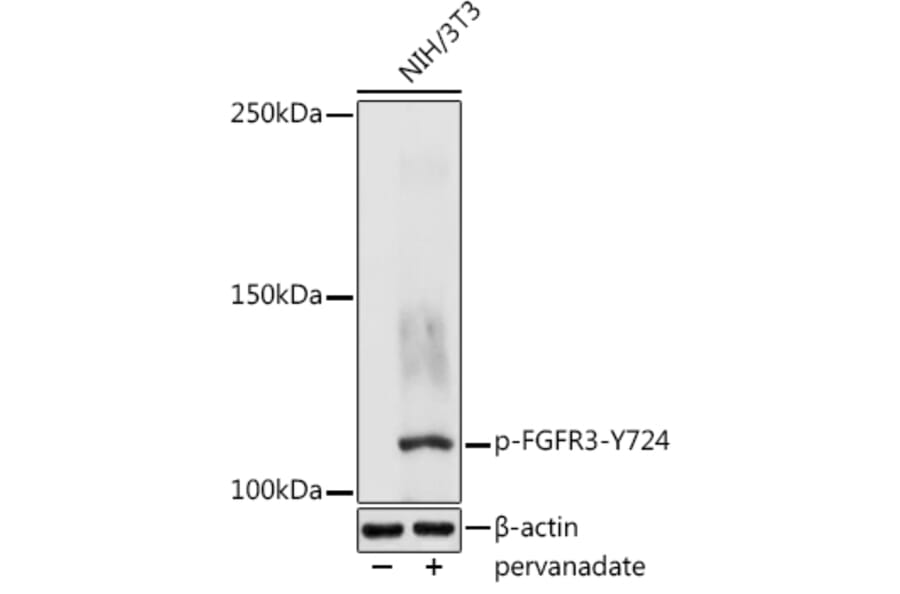 Western Blot - Anti-FGFR3 (phospho Tyr724) Antibody (A305605) - Antibodies.com