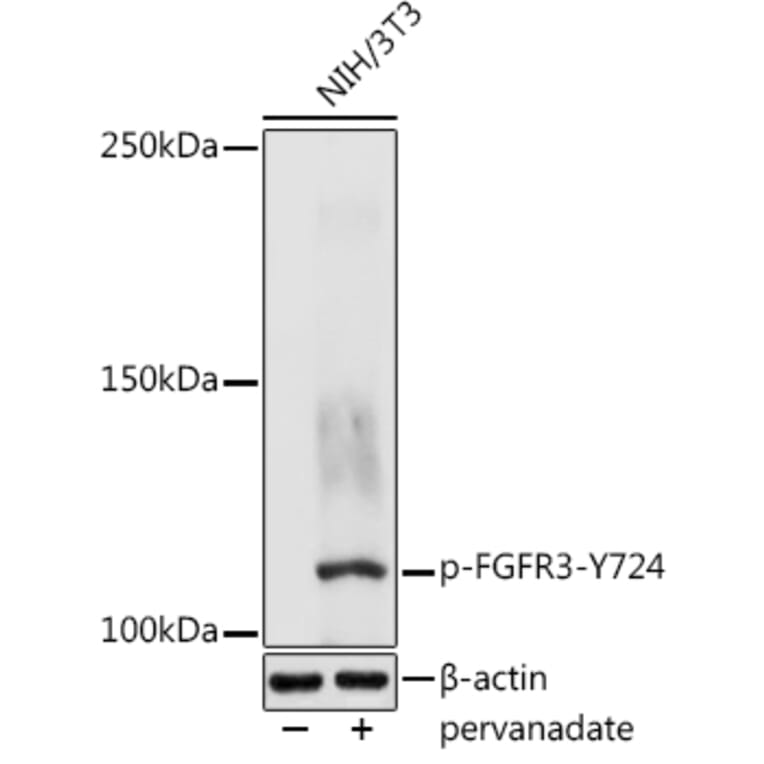 Western Blot - Anti-FGFR3 (phospho Tyr724) Antibody (A305605) - Antibodies.com