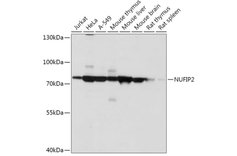 Western Blot - Anti-NUFIP2 Antibody (A305606) - Antibodies.com
