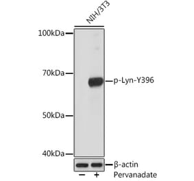 Western Blot - Anti-Lyn (phospho Tyr396) Antibody [ARC1597] (A305607) - Antibodies.com