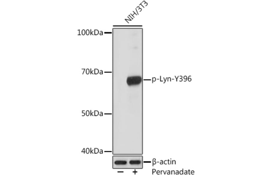 Western Blot - Anti-Lyn (phospho Tyr396) Antibody [ARC1597] (A305607) - Antibodies.com